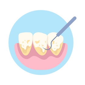 Dental Clearning And Teeth Whitening at Polymedica Dental and Medical Centre