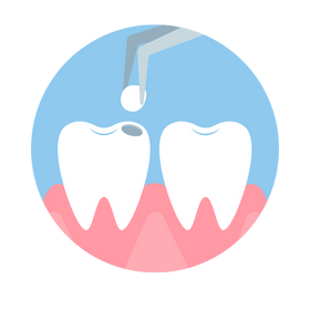 Kids Dental Filling at Polymedica Dental and Medical Centre